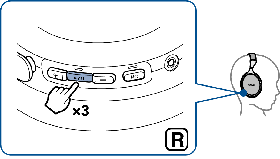 Ope Previous Track GC30